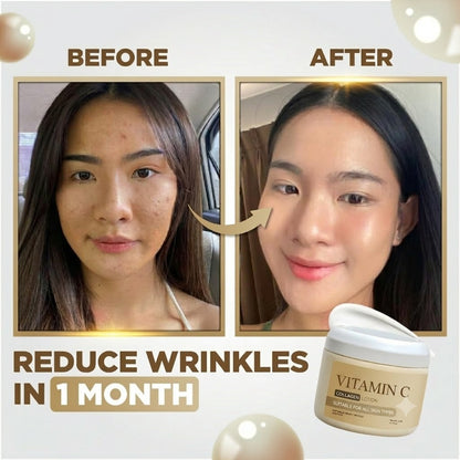 Whitening And Dark Spot Treatment Cream