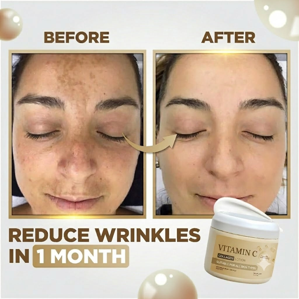 Whitening And Dark Spot Treatment Cream